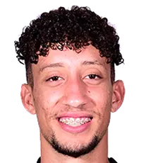 Júlio César Alves Gonçalvesdisparo a la cabeza