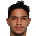 Pedro Mendesdisparo a la cabeza